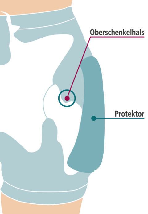 Pantaloncini per protezione anca